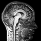 Illustration for article titled The Lazarus sign can convince you that brain-dead people are alive